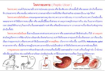 ใบความรู้ 21 โรคกระเพาะ.JPG