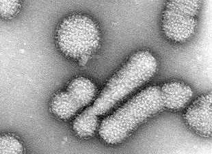 China-To-Spend-US49m-To-Control-The-H7N9-Avian-Flu.jpg